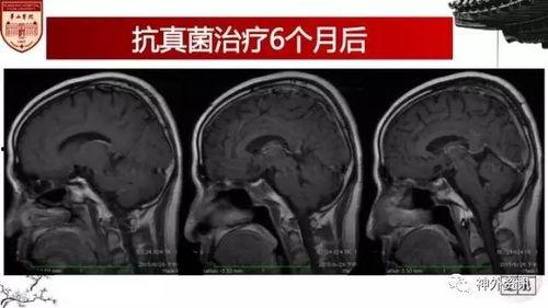 滚蛋吧霉运系统,滚蛋吧，霉运系统全面解析